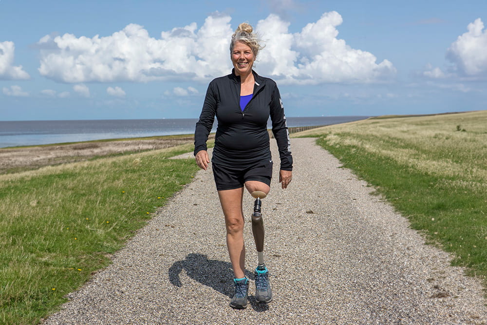 Eine Frau mit Endo-Exo-Prothese ist an der Küste beim Wandern zu sehen.