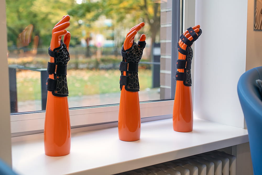 In einem Schaufenster stehen drei orange Kunststoffhände mit unterschiedlichen Handorthesen.